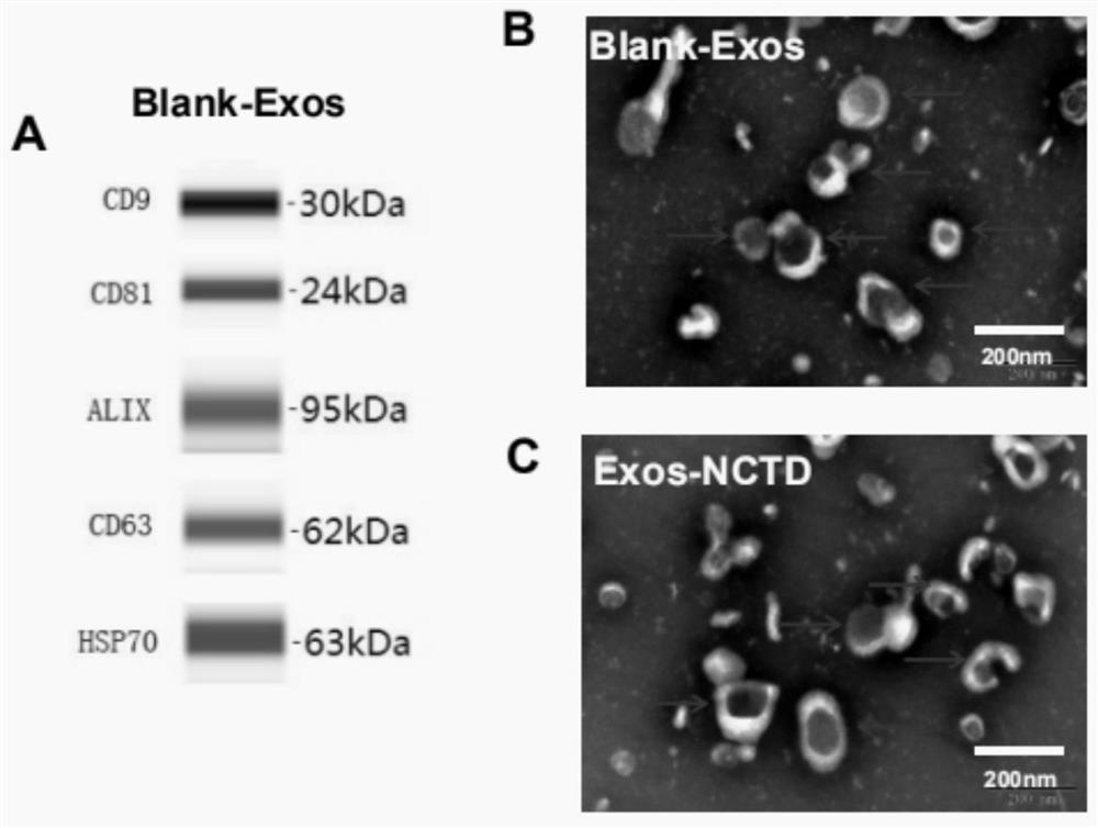 Preparation method and application of norcantharidin-loaded exosome