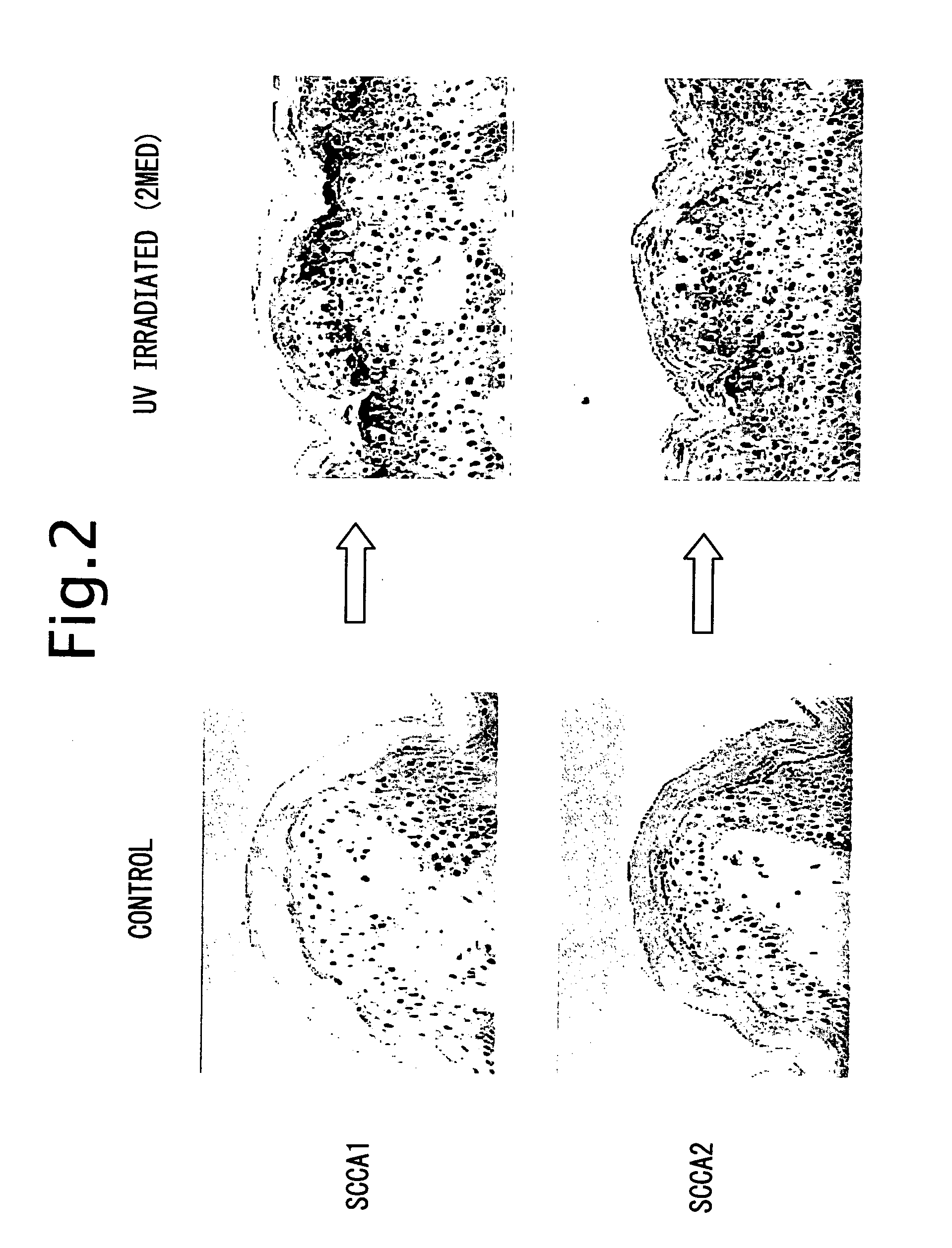 Method for inhibiting jnk-1 kinase activity by SCCA