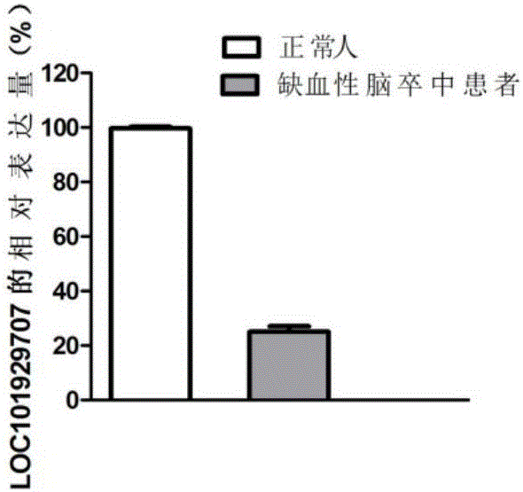 Application of lncRNA (long non-coding ribonucleic acid) to diagnosing cerebral ischemic stroke