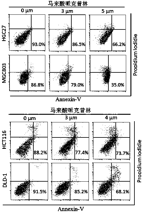 Application of perhexiline in the treatment of gastric cancer and intestinal cancer