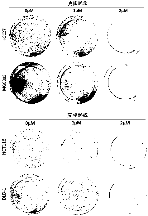 Application of perhexiline in the treatment of gastric cancer and intestinal cancer