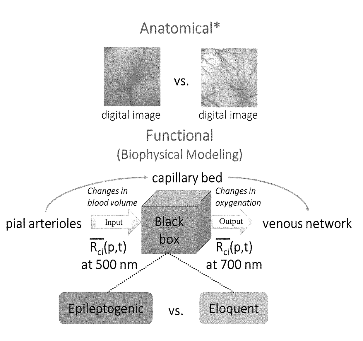 Hybrid spectroscopy imaging system for intraoperative epileptic cortex detection