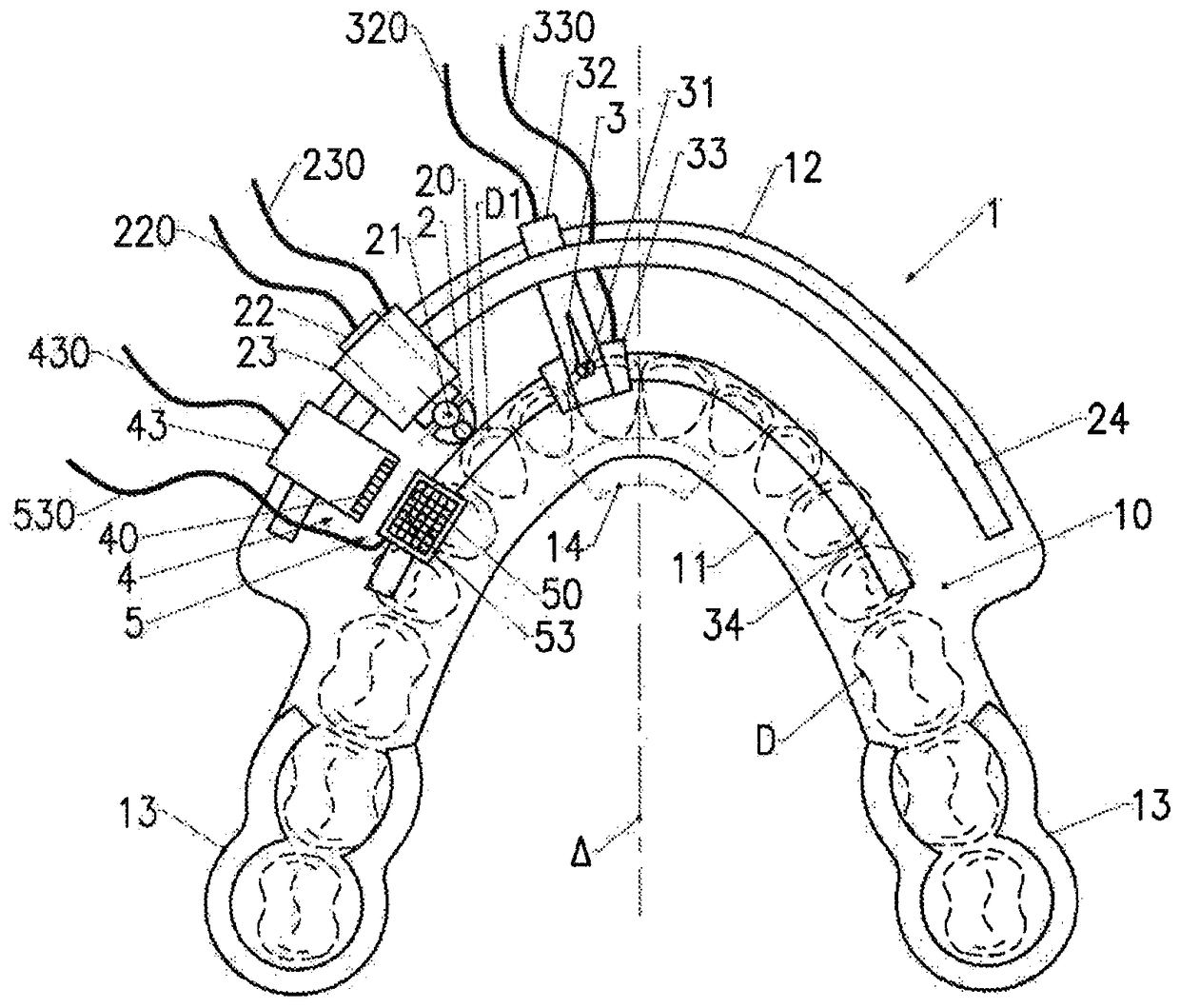 Automatic tooth preparation equipment in the oral cavity, used for partial tooth restoration or peripheral nerve restoration