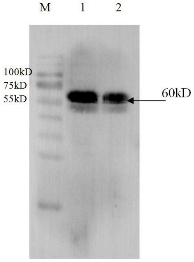 Anti-Mullerian hormone latex-enhanced turbidimetric detection kit and its preparation and use method