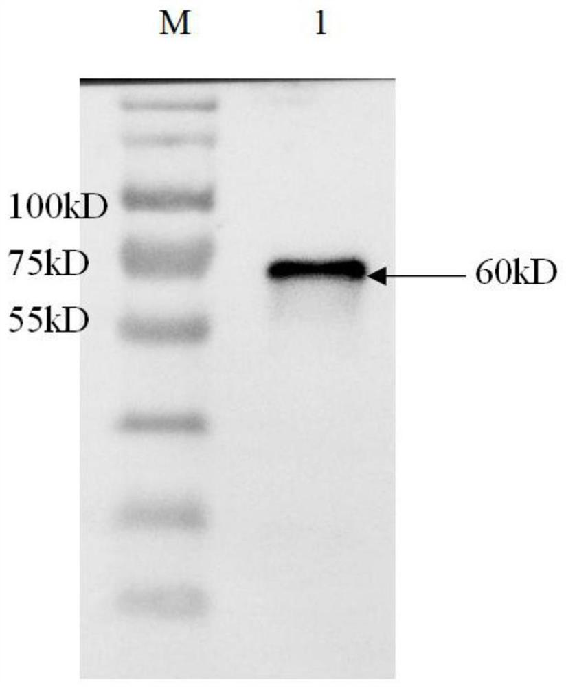 Anti-Mullerian hormone latex-enhanced turbidimetric detection kit and its preparation and use method