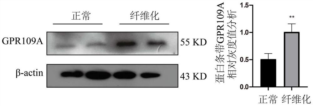 Application of nicotinic acid in preparation of drug for relieving mammary gland fibrosis of dairy cows through GPR109A receptors