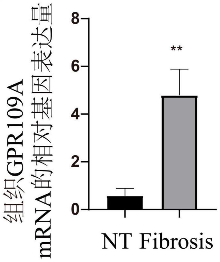 Application of nicotinic acid in preparation of drug for relieving mammary gland fibrosis of dairy cows through GPR109A receptors