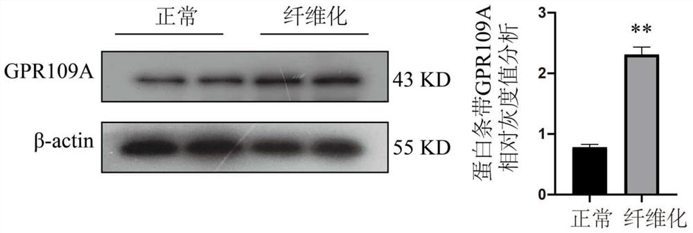 Application of nicotinic acid in preparation of drug for relieving mammary gland fibrosis of dairy cows through GPR109A receptors