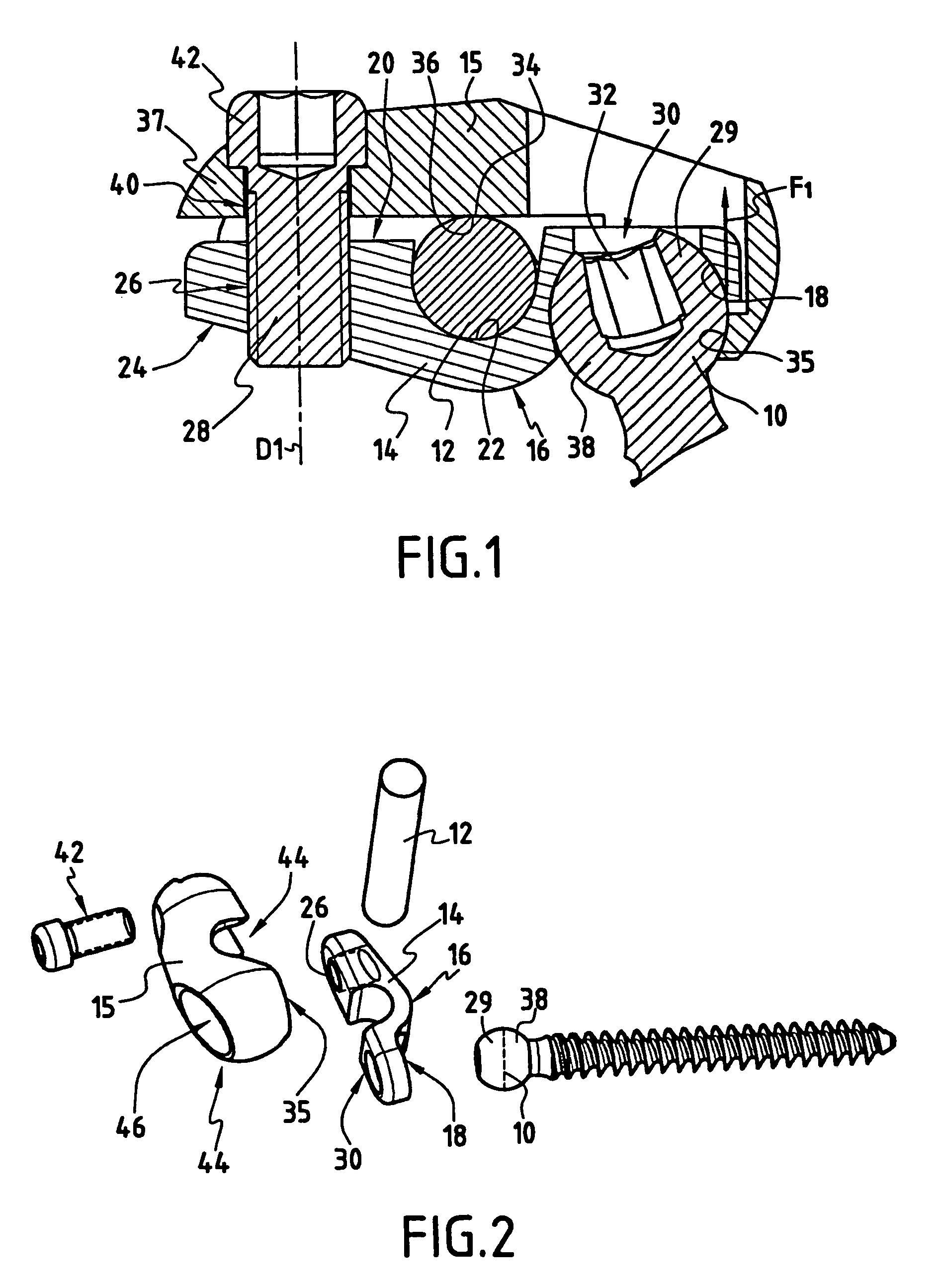 Device for fixing a rod and a spherical symmetry screw head