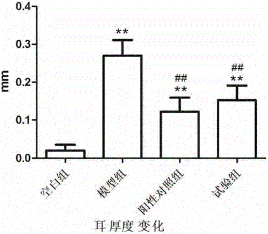 Traditional Chinese medicinal composition for treating eczema and application thereof