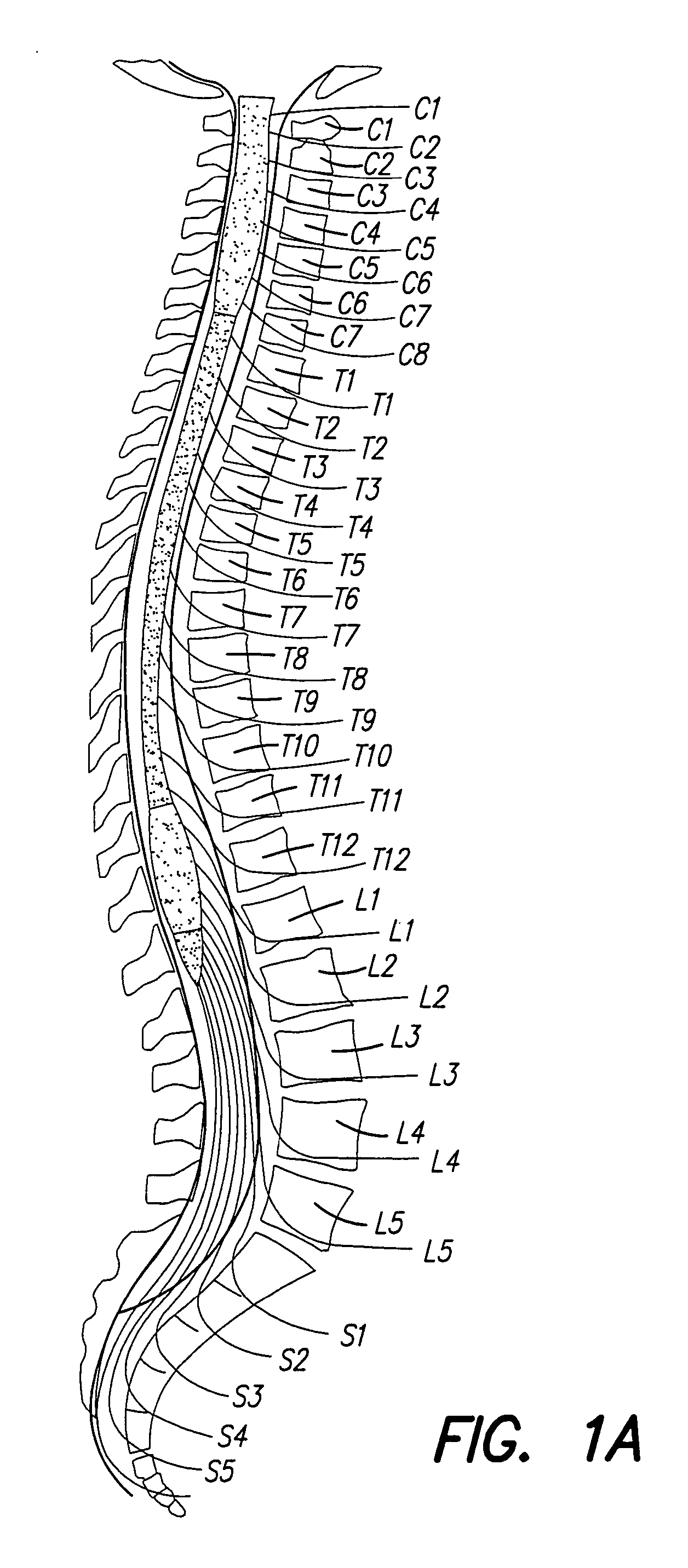 Methods for implanting a spinal cord stimulator