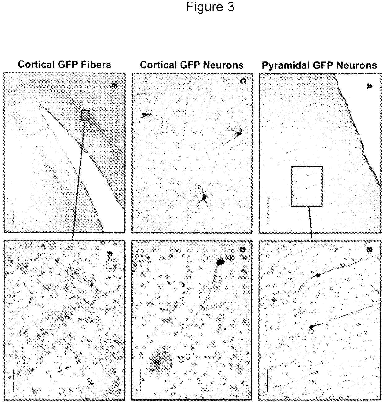 Methods for distributing high levels of therapeutic agent throughout the cortex to treat neurological disorders