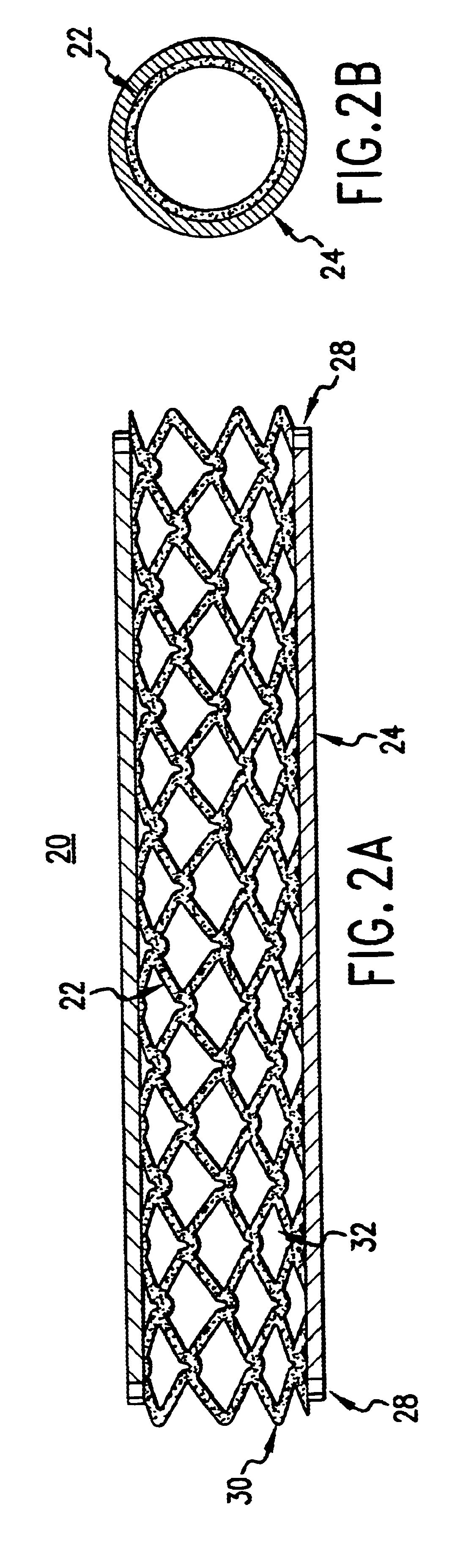 Stent having cover with drug delivery capability