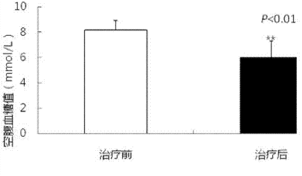 Healthcare product for auxiliary treatment of type 2 diabetes, and preparation method thereof