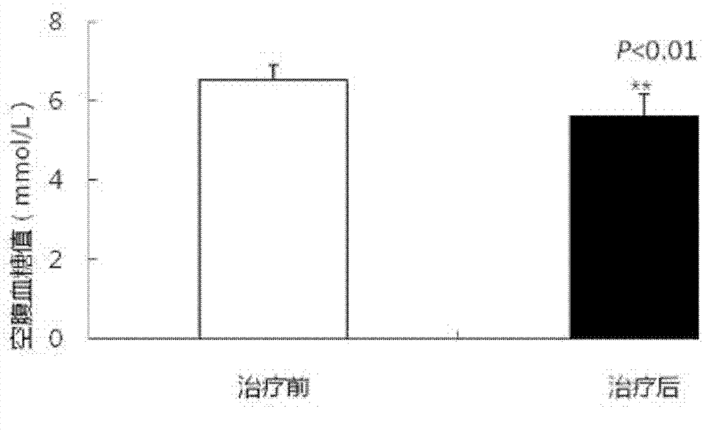 Healthcare product for auxiliary treatment of type 2 diabetes, and preparation method thereof