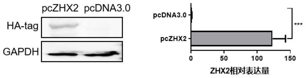 Application of transcription factor zhx2 in NK cell regulation