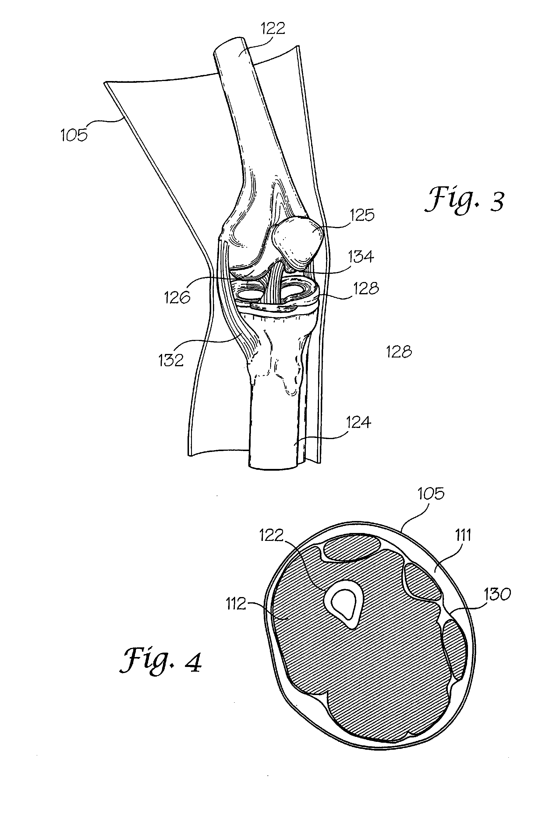 Joint replica models and methods of using same for testing medical devices