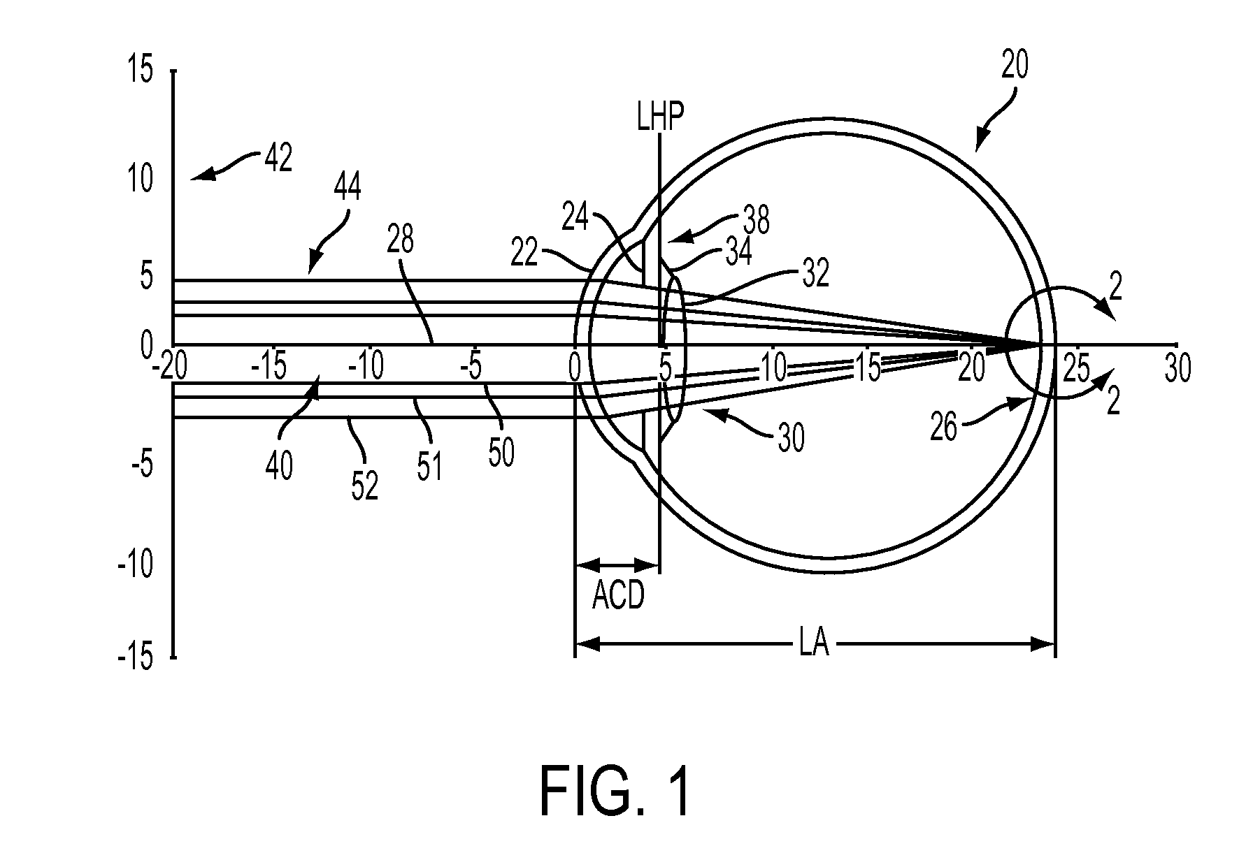 Apparatus, system and method to account for spherical aberration at the iris plane in the design of an intraocular lens