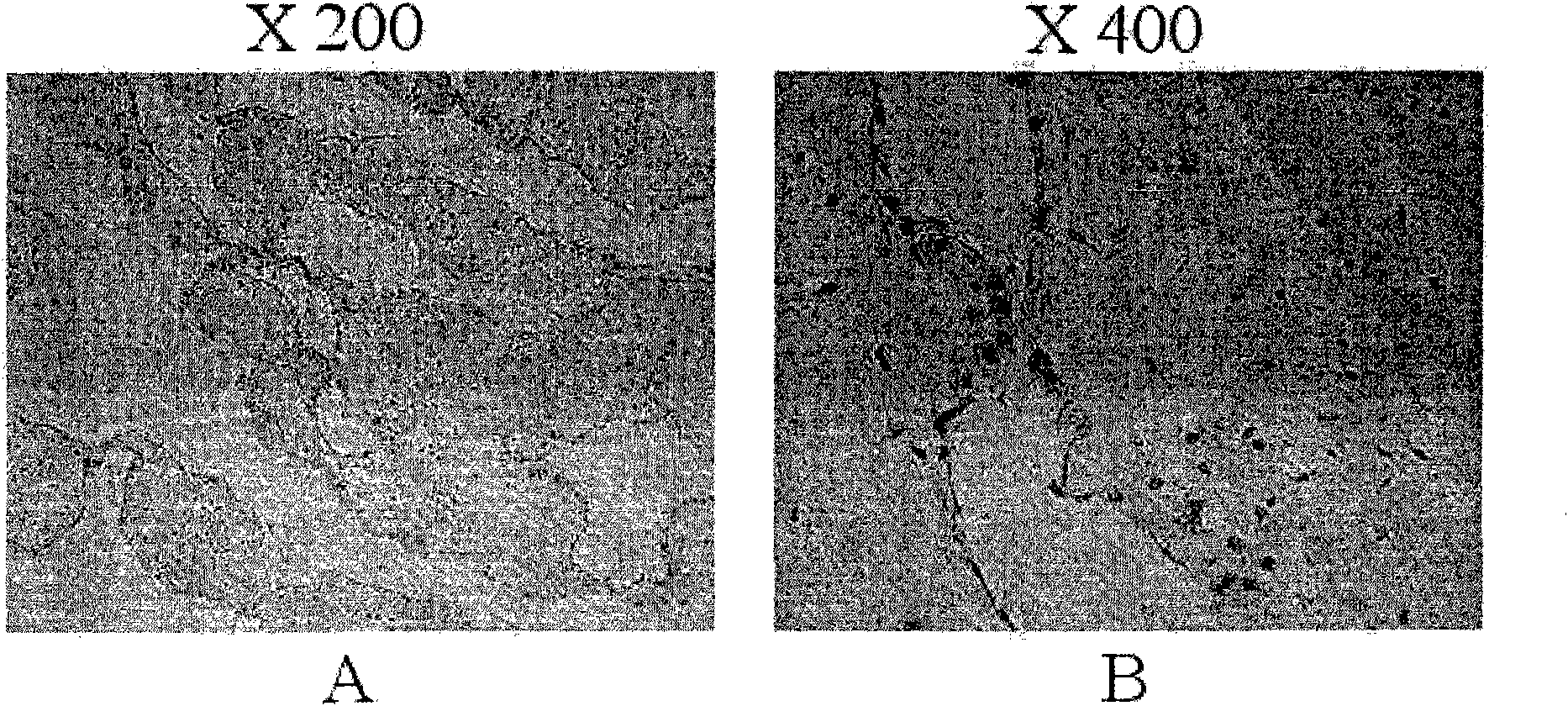 Method for preparing a cell-derived extracellular matrix membrane