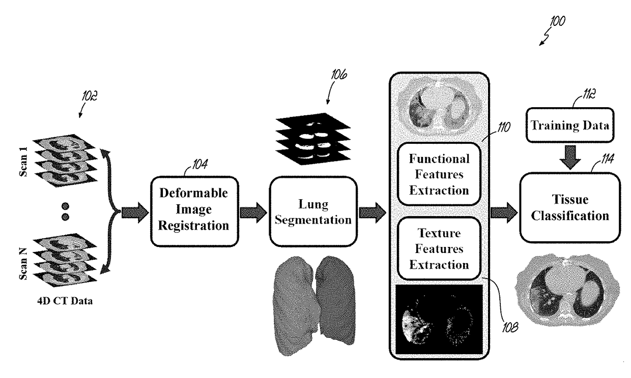 Accurate detection and assessment of radiation induced lung injury based on a computational model and computed tomography imaging