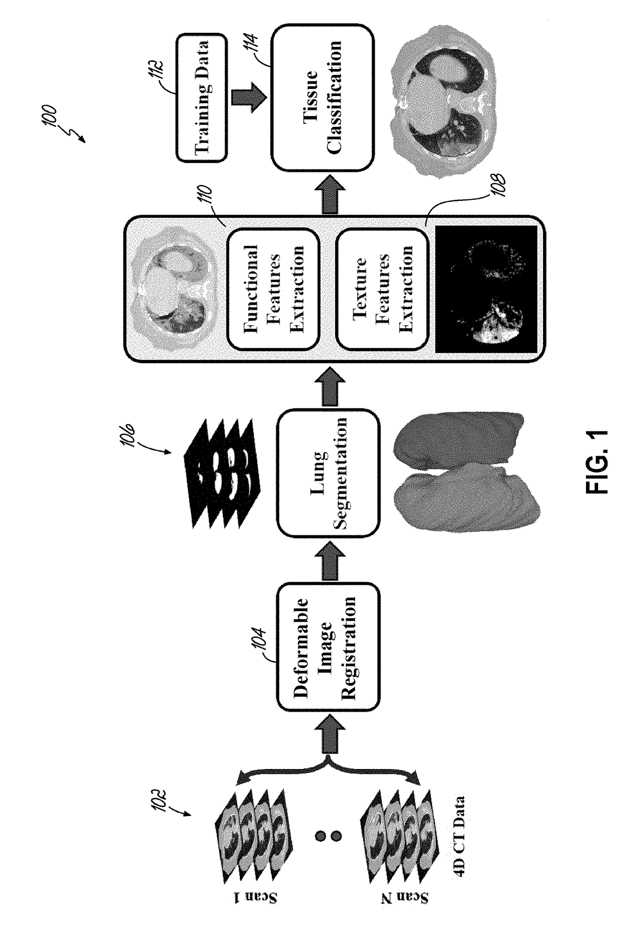 Accurate detection and assessment of radiation induced lung injury based on a computational model and computed tomography imaging