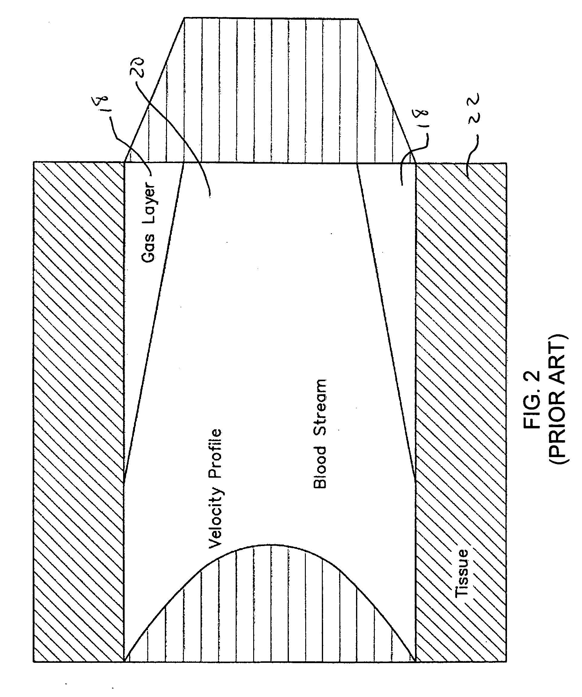 Dive computer and method for determining gas formation