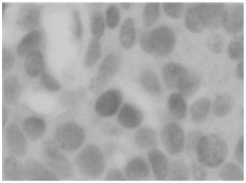 A Cell Counting Method Based on Skeleton Extraction