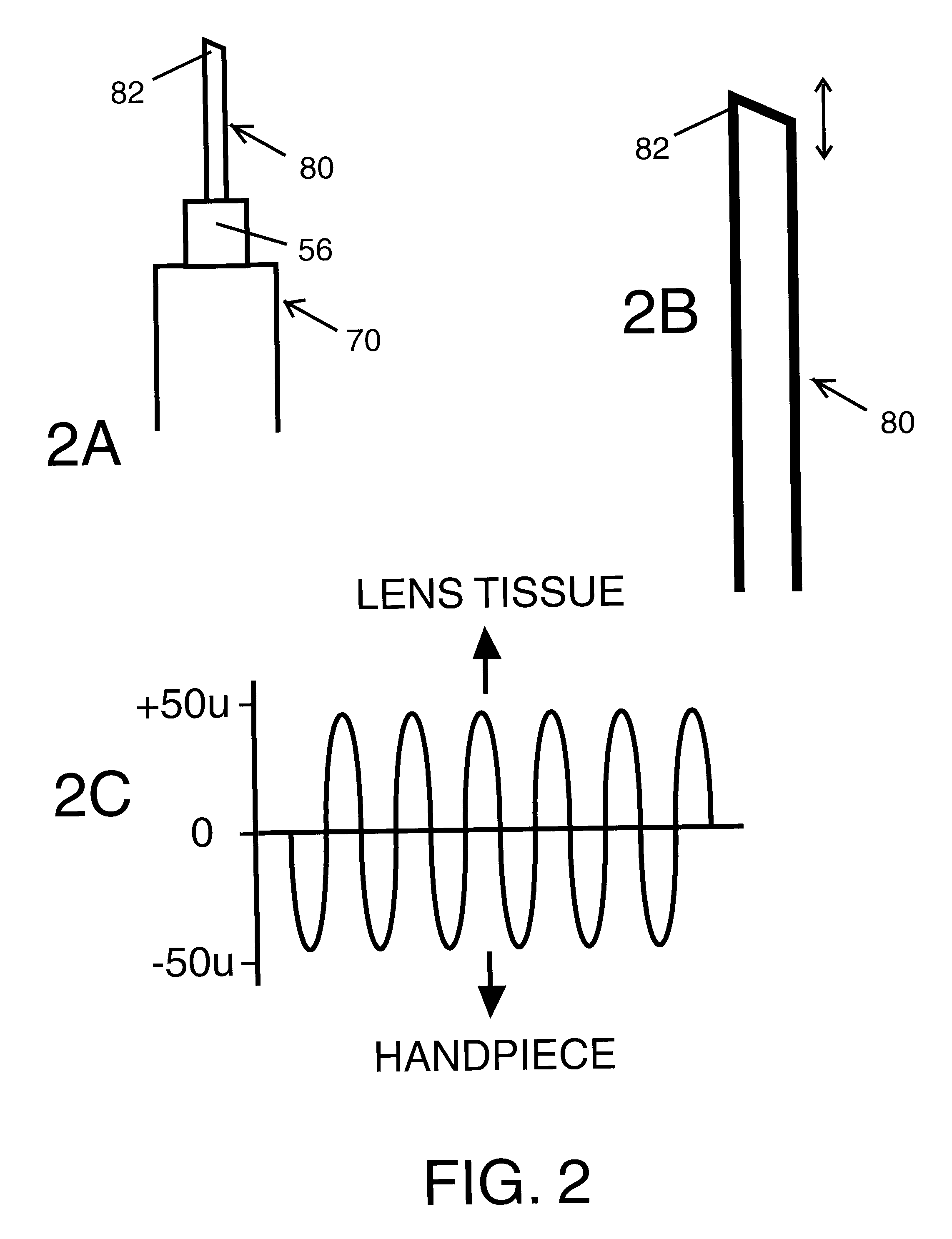 Repetitive progressive axial displacement pattern for phacoemulsifier needle tip