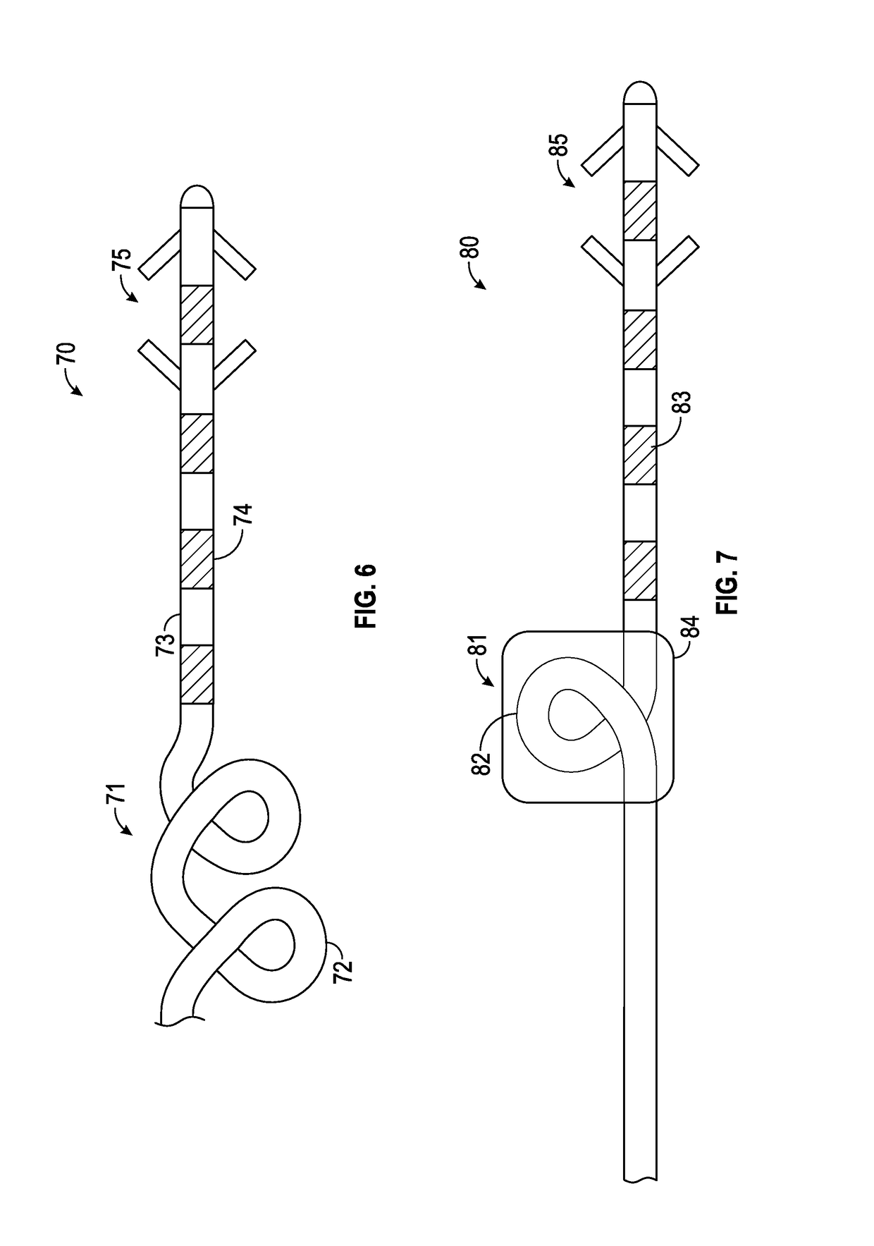 Electrode leads for use with implantable neuromuscular electrical stimulator