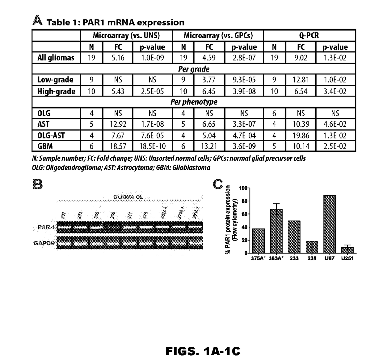 Use of inhibitors of binding between a par-1 receptor and its ligands for the treatment of glioma