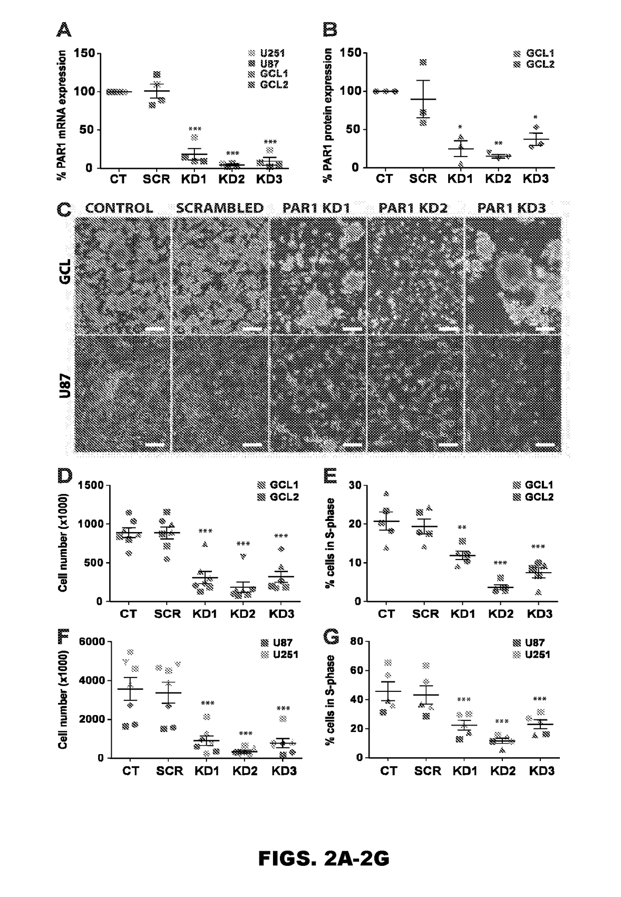 Use of inhibitors of binding between a par-1 receptor and its ligands for the treatment of glioma