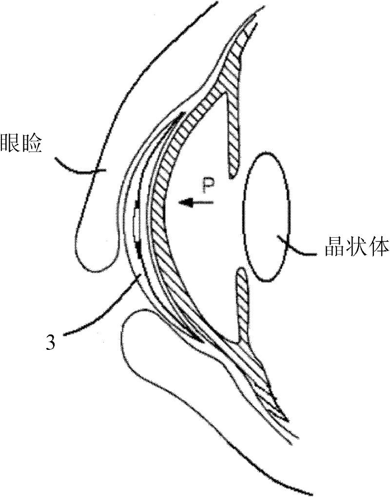Intraocular tension testing device
