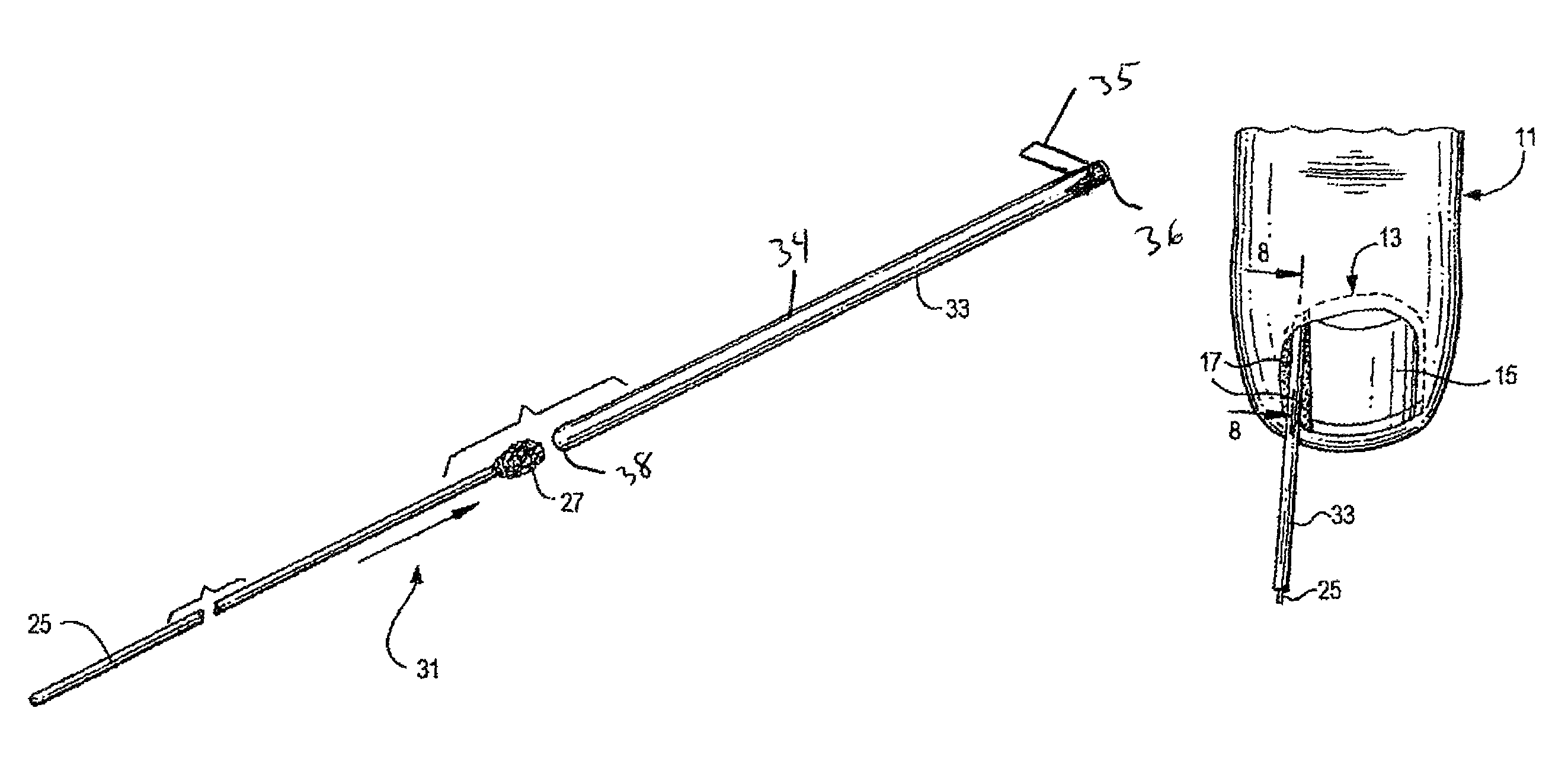 Device and method of treating a nail condition
