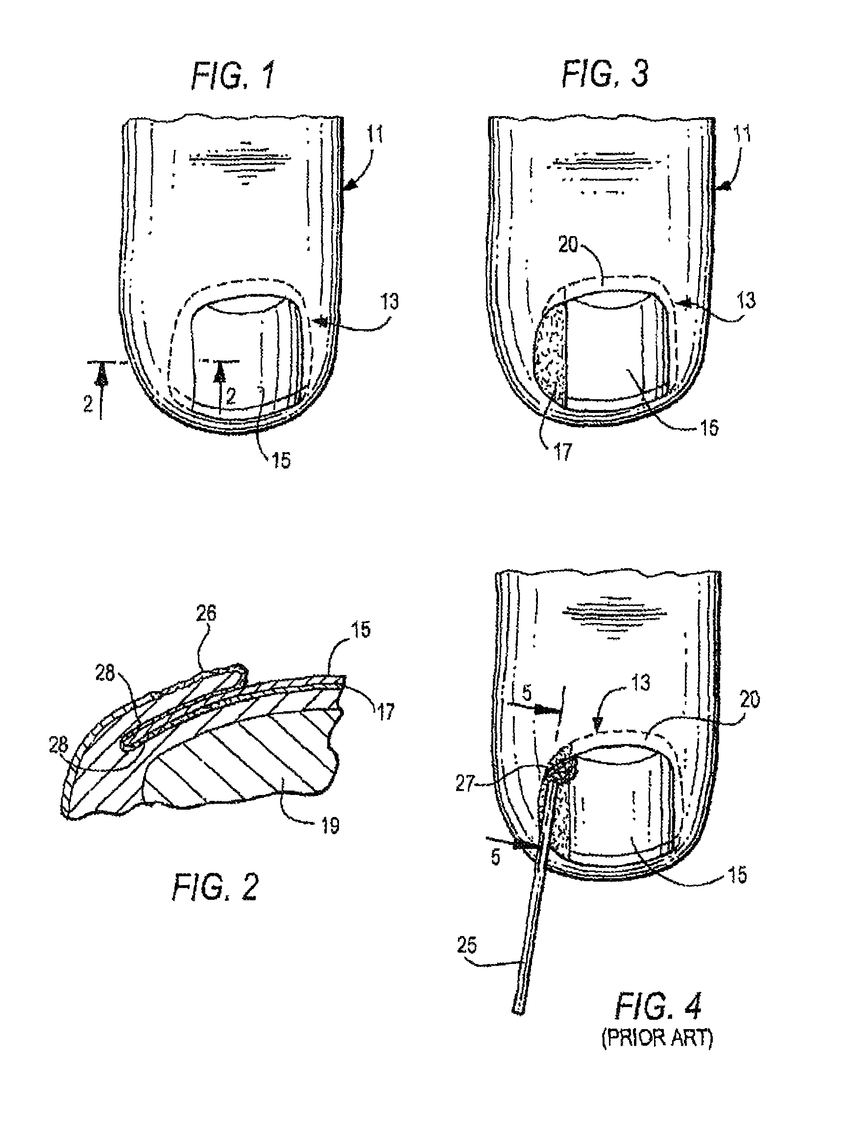 Device and method of treating a nail condition
