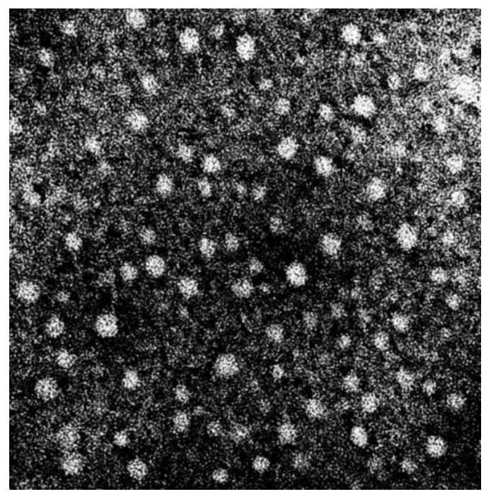Composition, preparation method and application of cisplatin microparticles