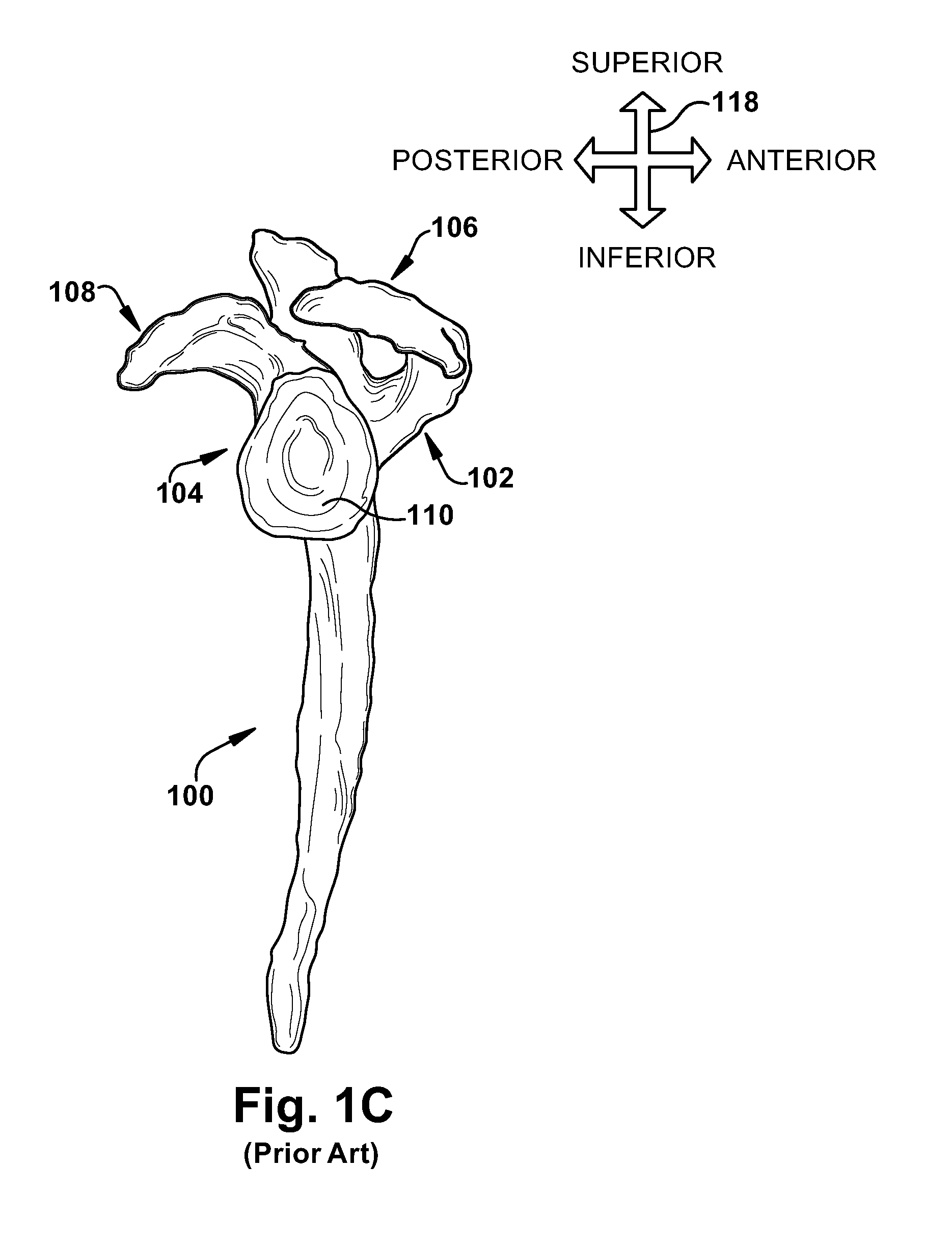 System of preoperative planning and provision of patient-specific surgical aids