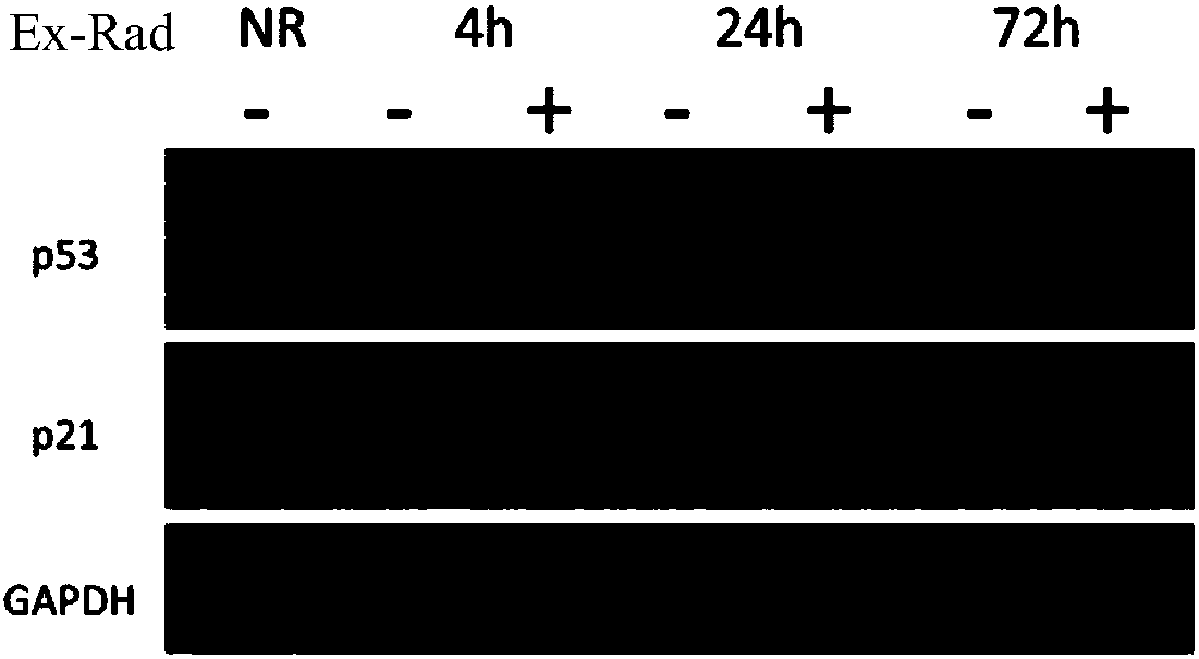 Benzimidazole derivative and preparation method and application thereof