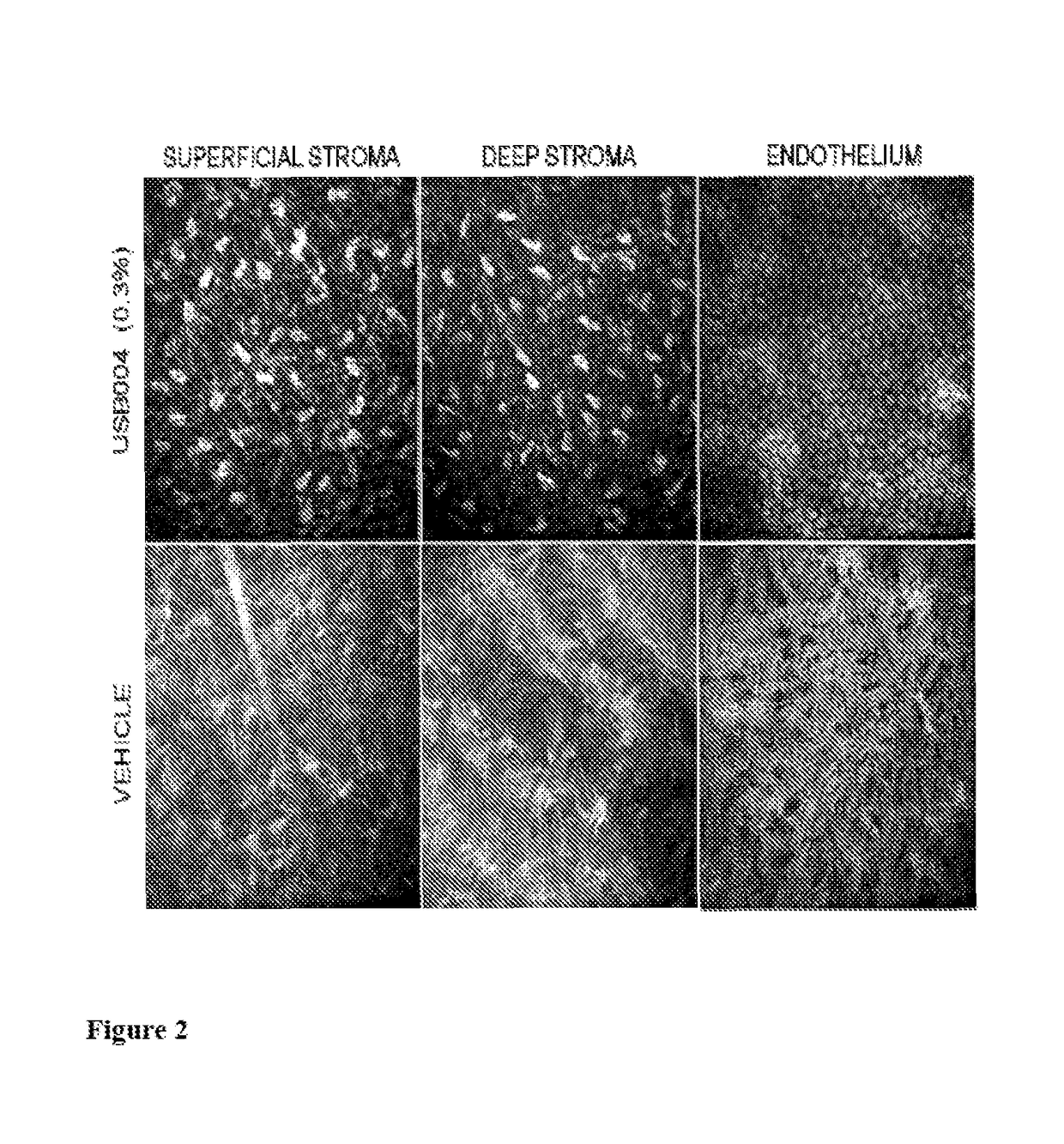 Accelerated healing of eye injuries by angiotensin peptides