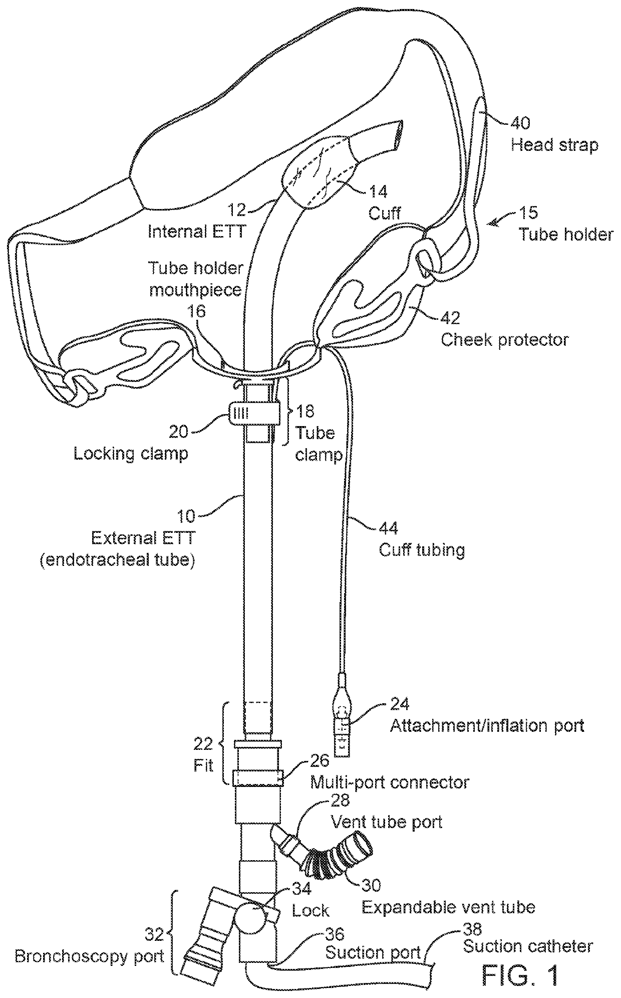 Endotracheal tube guard with optional holding system and optional sensor