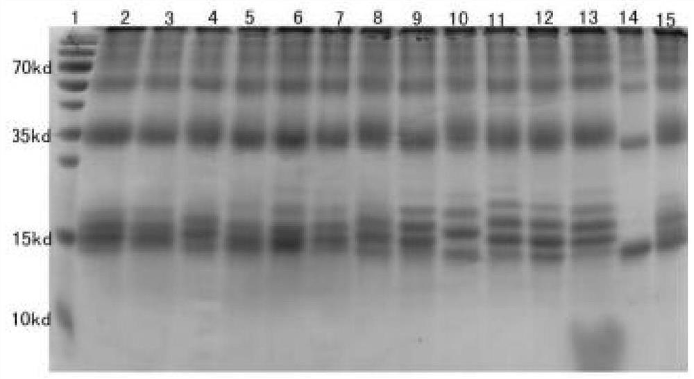 Monoclonal Antibody b and Application of Shrimp Hepatopancreatic Pathogenic Toxin Pira