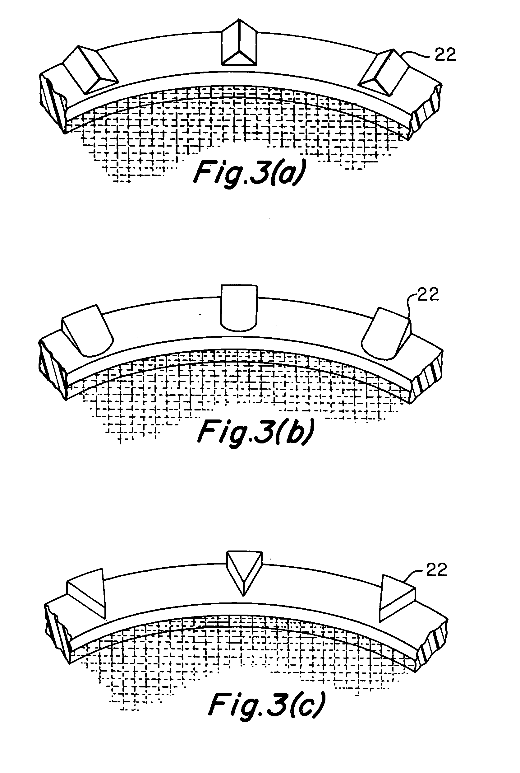 Implantable prosthesis and method and apparatus for loading and delivering an implantable prosthesis