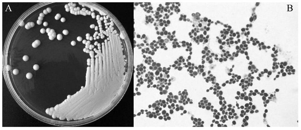 A cold-water fish probiotic Lactococcus lactis strain and its application