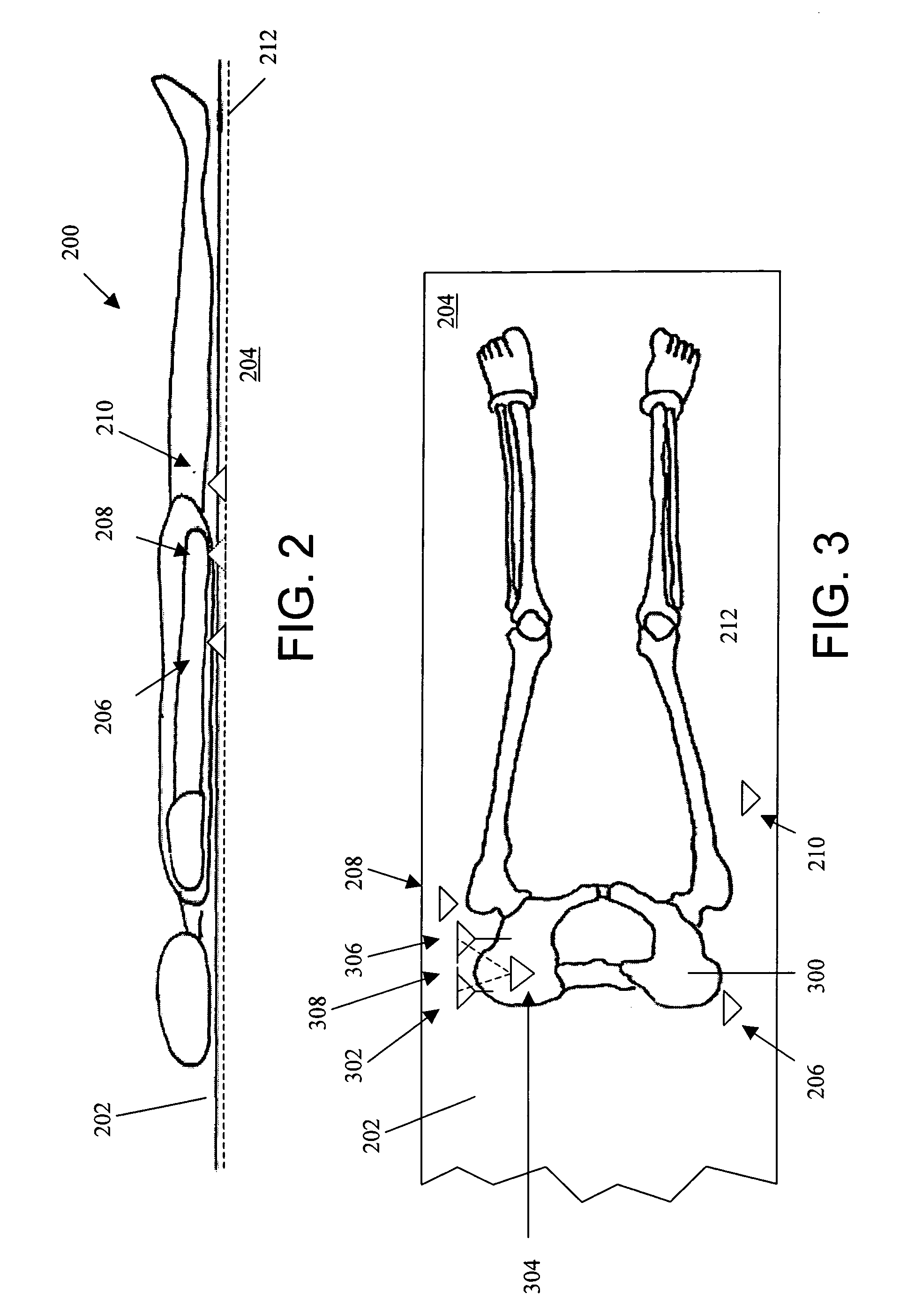 Systems and methods for providing a reference plane for mounting an acetabular cup during a computer-aided surgery