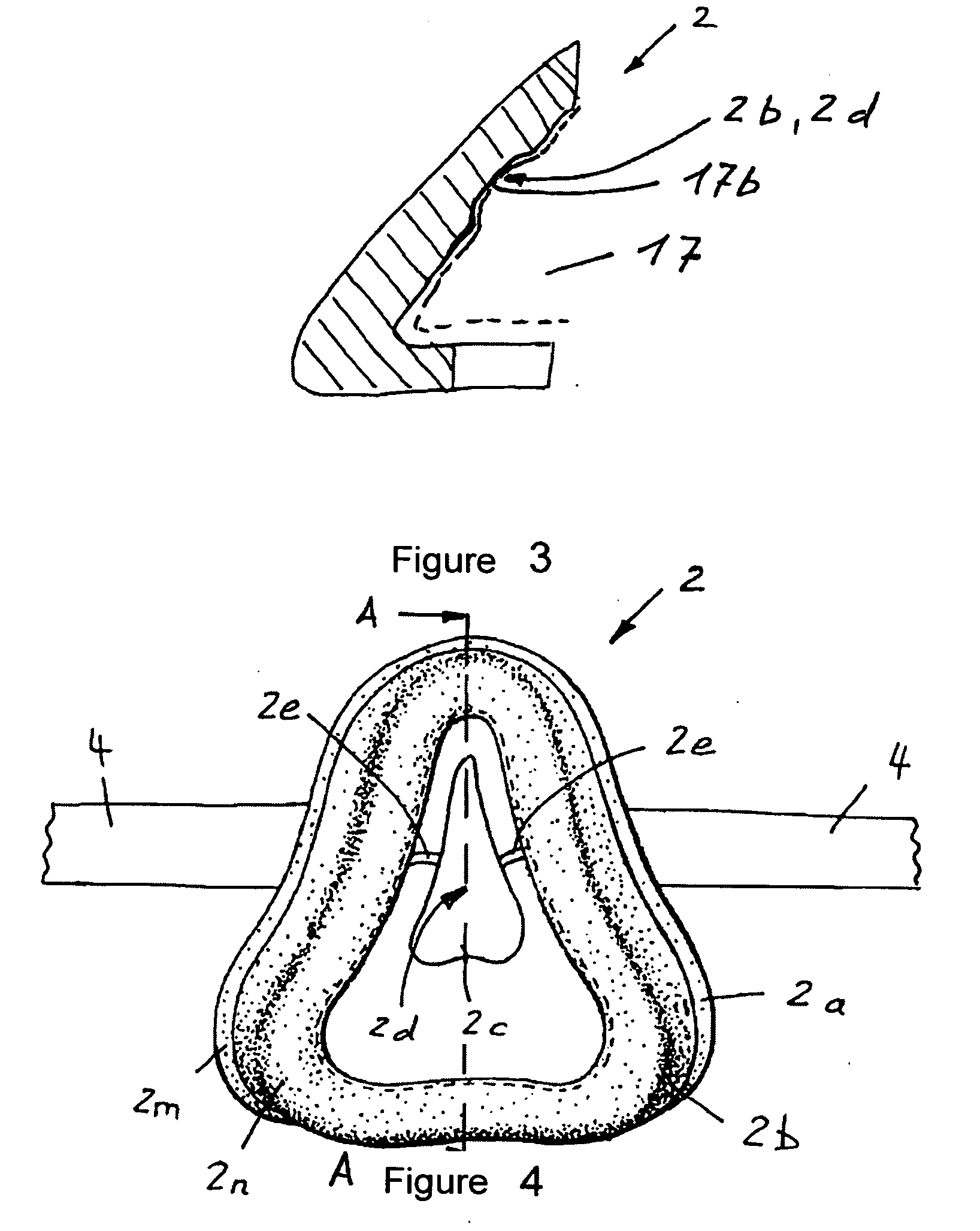 Device for reshaping bones