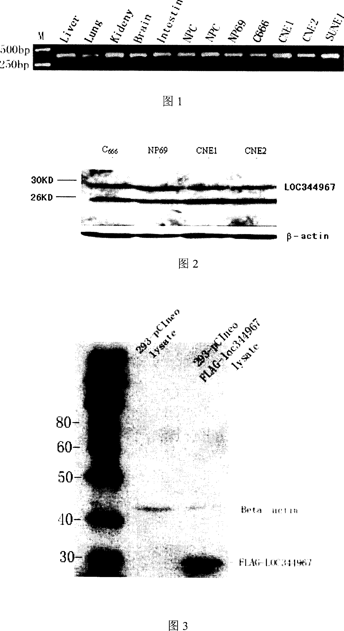 Human new gene LOC344967 correlated with nasopharyngeal carcinoma and coding protein product thereof