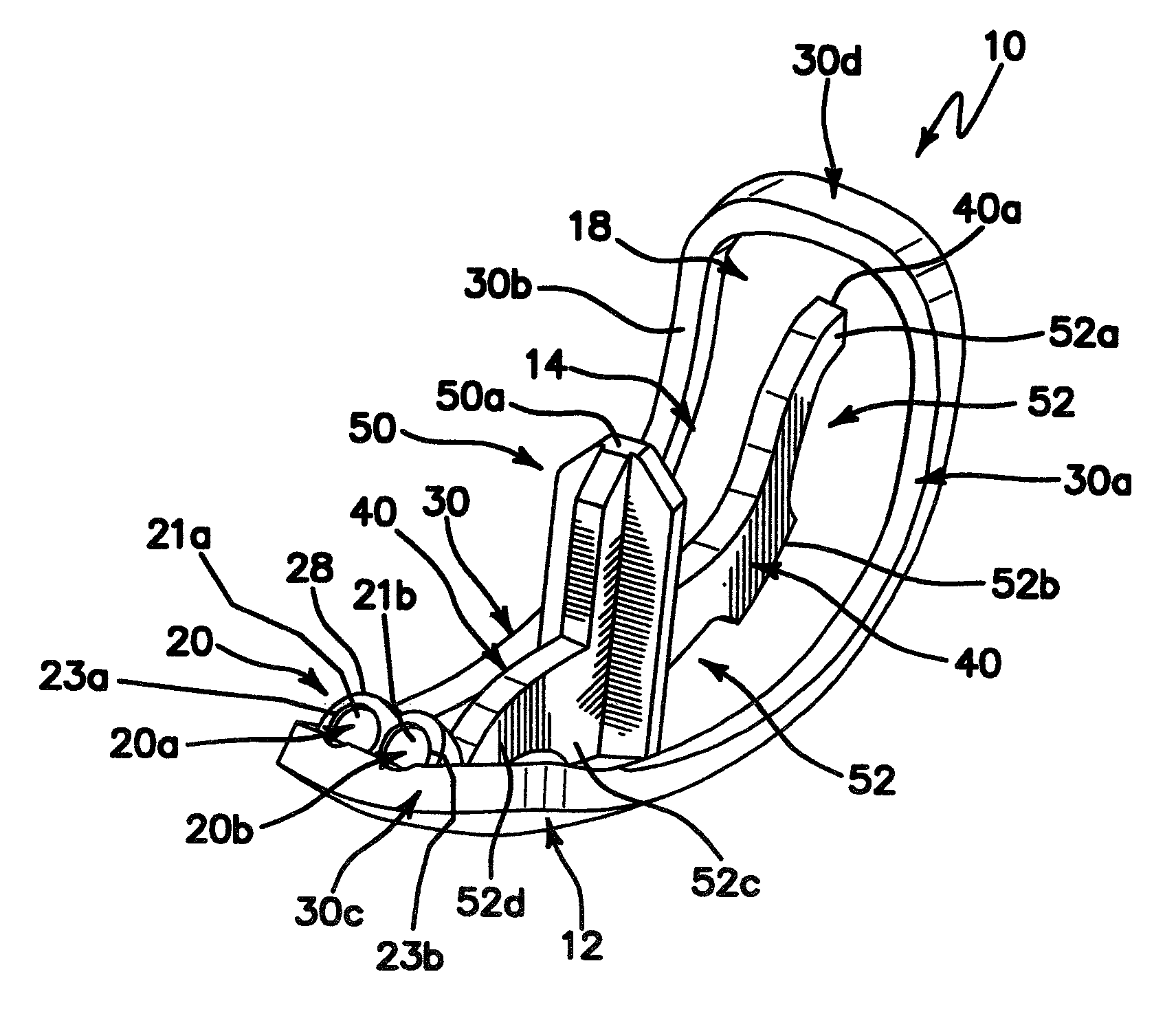 Femoral prosthesis