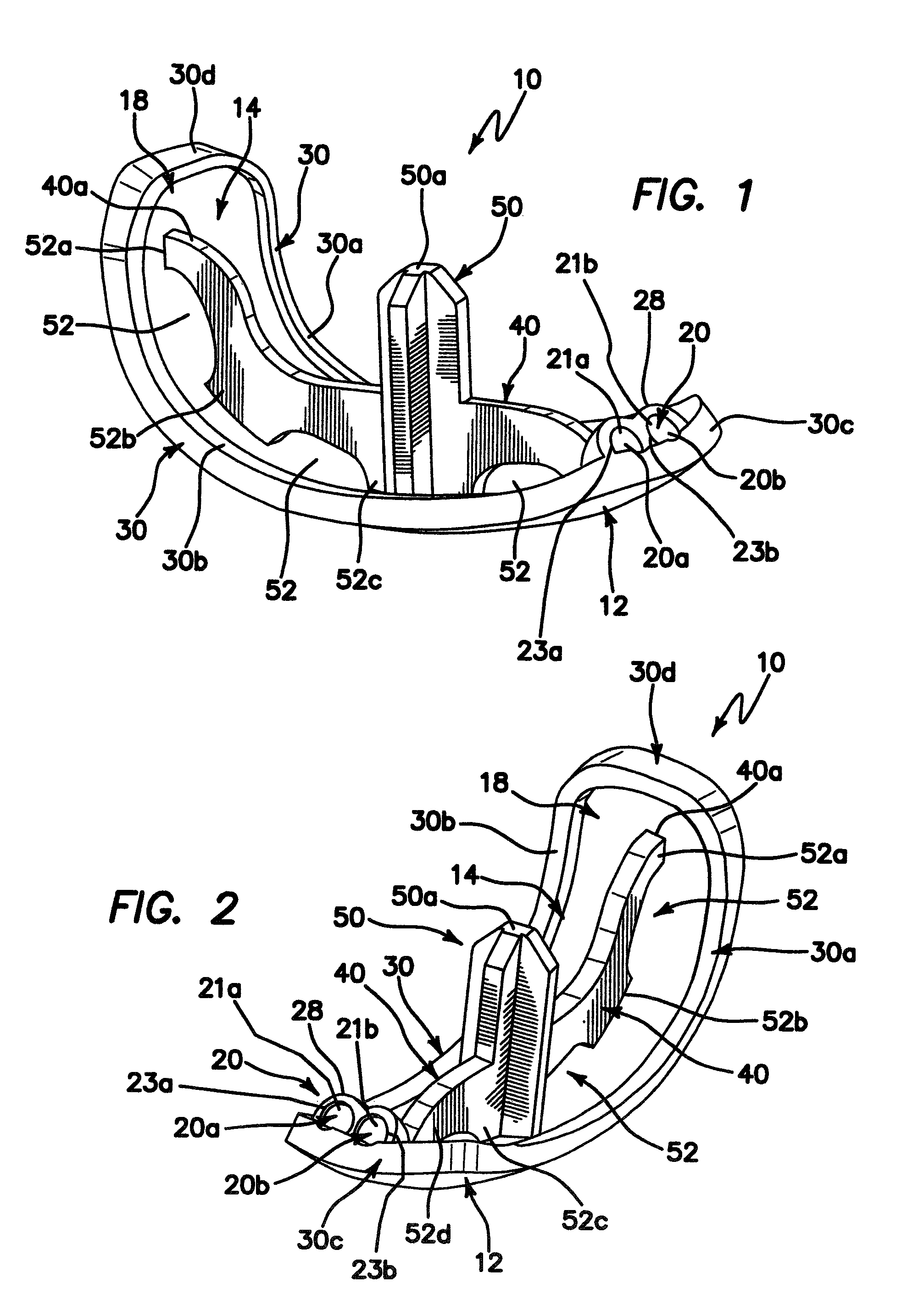 Femoral prosthesis