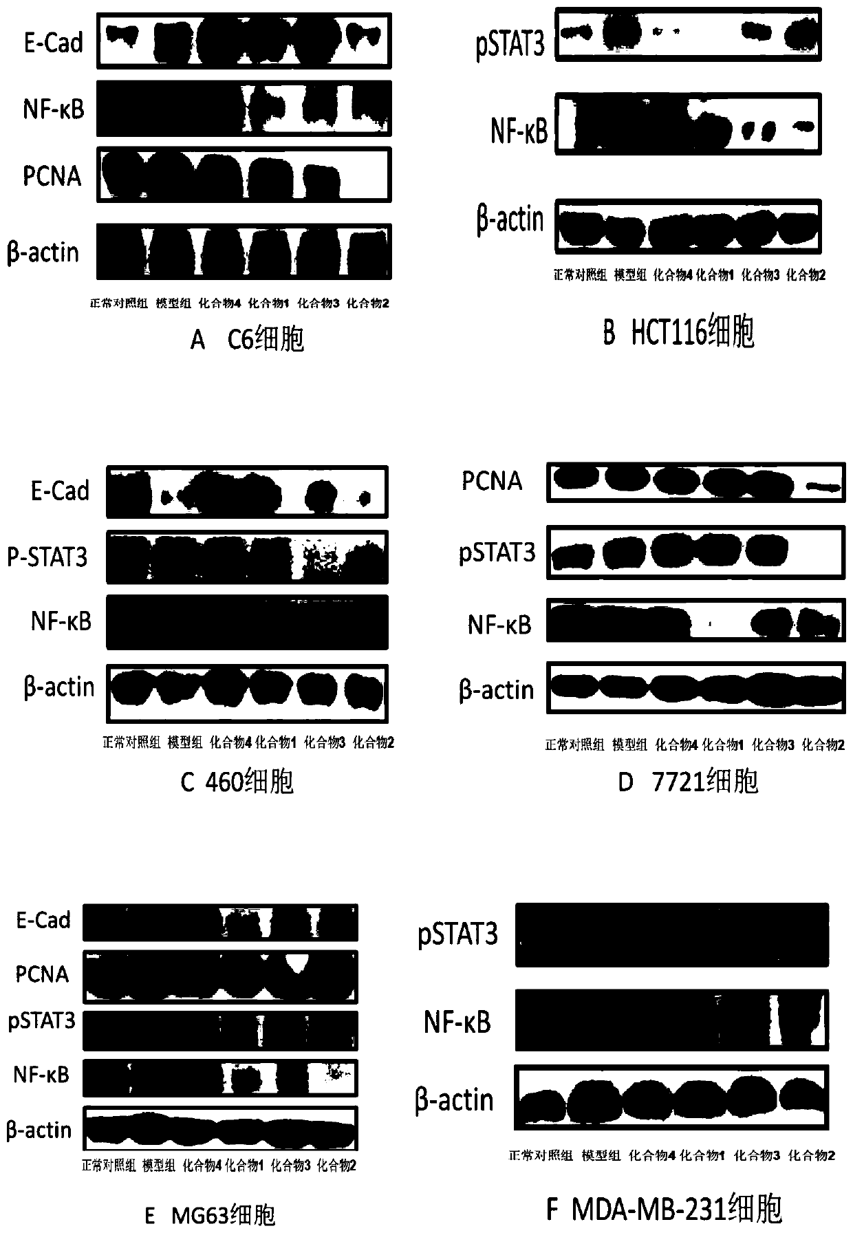 Hydrophilic berberine type derivative connected with R10 and R11 and application of hydrophilic berberine type derivative to preparation of drugs