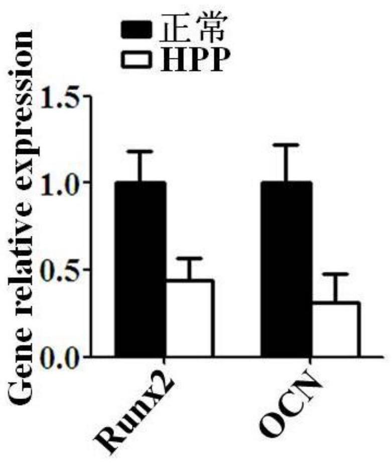 Application of AMPK activator in preparation of product for improving abnormal AMPK signaling pathway in bone marrow mesenchymal stem cells