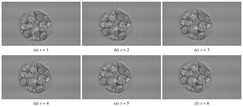 Improved image segmentation method for geometric active contour